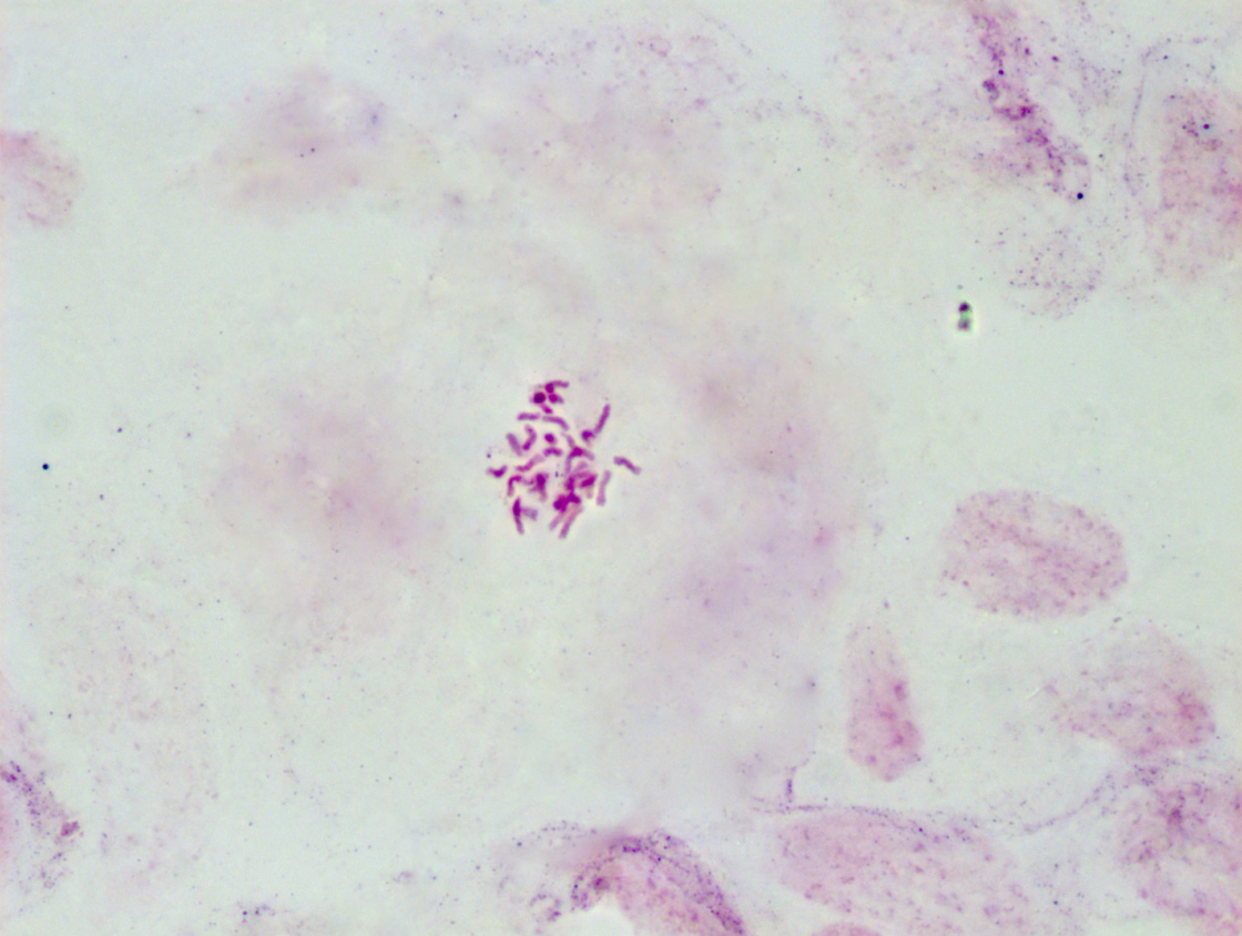 Stained chromosomes of Styrax faberi